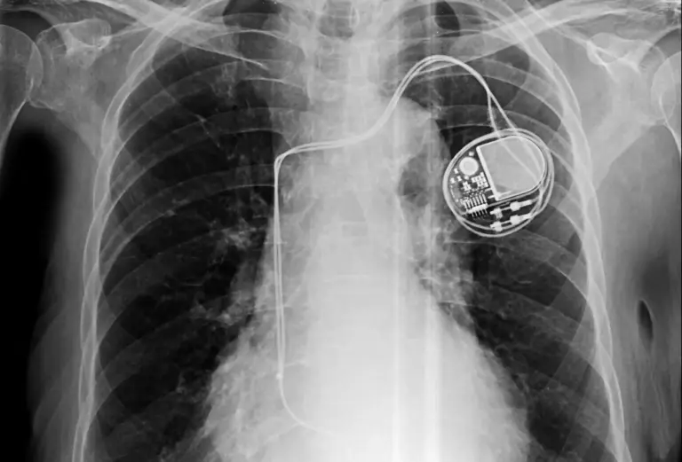 Medical Device Manufacturing